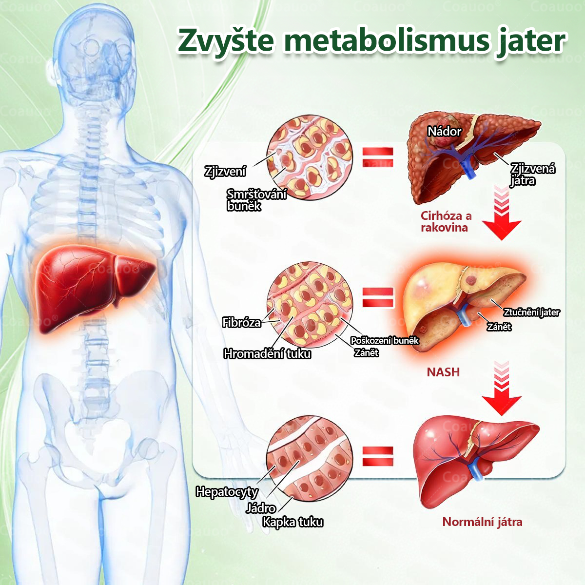 Oficiální prodejna  |  🧑‍⚕️𝐂𝐨𝐚𝐮𝐨𝐨® 𝐌𝐨𝐫𝐢𝐧𝐠𝐚 × 𝐁𝐞𝐫𝐛𝐞𝐫𝐲𝐧𝐚 × 𝐀𝐌𝐏𝐊 𝟏𝟎 v 1 – Zeštíhlující nano mikrojihlový náplast 🇨🇿 Jen 1× denně ✅ Viditelné změny za 7 dní – na obezitu, kardiovaskulární zdraví, diabetes a kloubní problémy