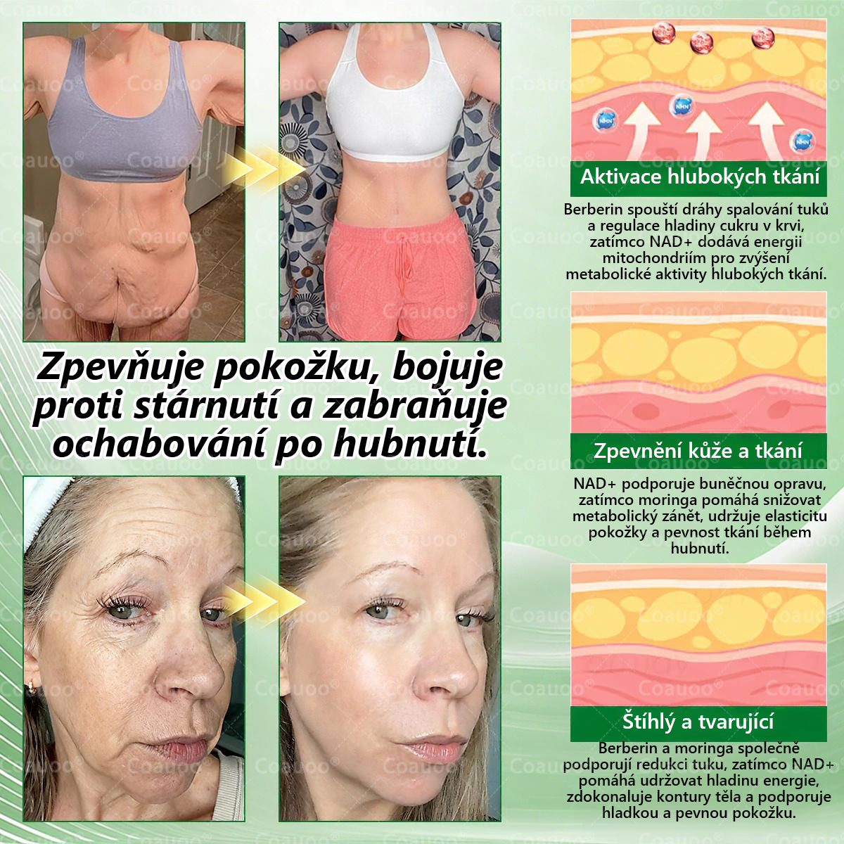 Oficiální prodejna  |  🧑‍⚕️𝐂𝐨𝐚𝐮𝐨𝐨® 𝐌𝐨𝐫𝐢𝐧𝐠𝐚 × 𝐁𝐞𝐫𝐛𝐞𝐫𝐲𝐧𝐚 × 𝐀𝐌𝐏𝐊 𝟏𝟎 v 1 – Zeštíhlující nano mikrojihlový náplast 🇨🇿 Jen 1× denně ✅ Viditelné změny za 7 dní – na obezitu, kardiovaskulární zdraví, diabetes a kloubní problémy