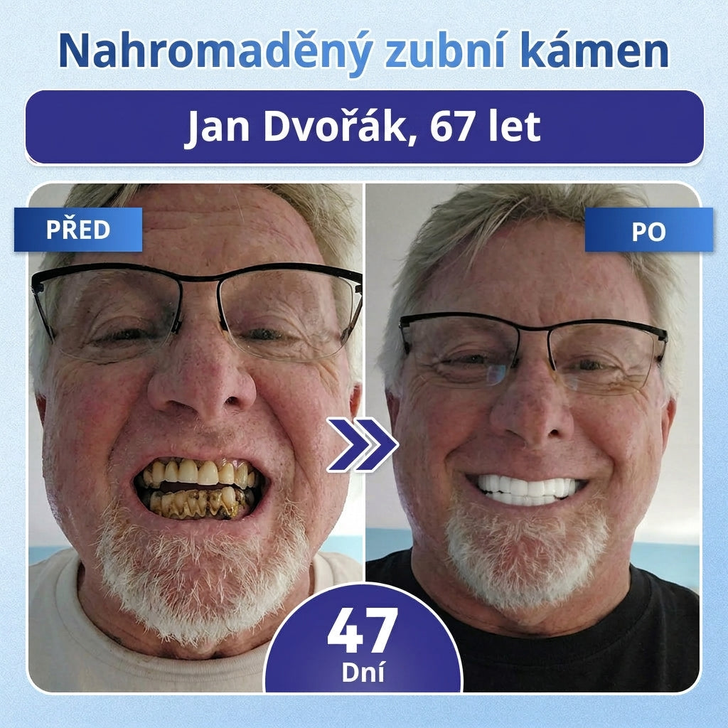 🎁 𝐂𝐨𝐚𝐮𝐨𝐨®Zbývá už jen 5 balení! Nabízíme vám dodatečnou slevu 50 %! 💪 Buďte fit a zdraví. Zhubněte teď — další šance bude až příští rok.