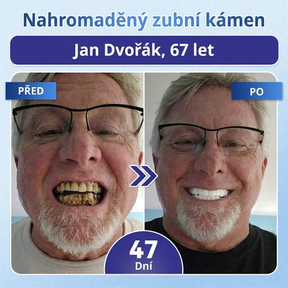 🎁 𝐂𝐨𝐚𝐮𝐨𝐨®Zbývá už jen 5 balení! Nabízíme vám dodatečnou slevu 50 %! 💪 Buďte fit a zdraví. Zhubněte teď — další šance bude až příští rok.