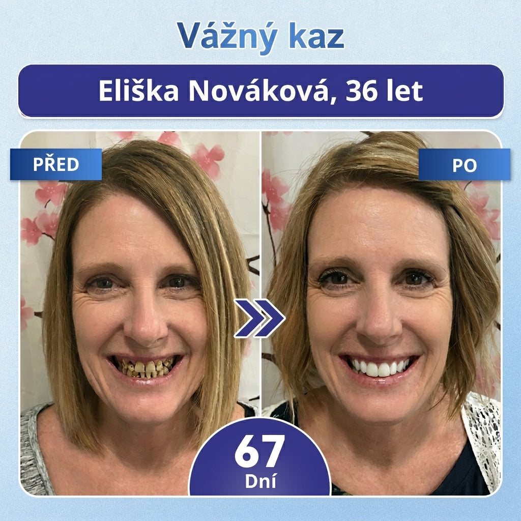 🎁 𝐂𝐨𝐚𝐮𝐨𝐨®Zbývá už jen 5 balení! Nabízíme vám dodatečnou slevu 50 %! 💪 Buďte fit a zdraví. Zhubněte teď — další šance bude až příští rok.