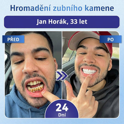 🎁 𝐂𝐨𝐚𝐮𝐨𝐨®Zbývá už jen 5 balení! Nabízíme vám dodatečnou slevu 50 %! 💪 Buďte fit a zdraví. Zhubněte teď — další šance bude až příští rok.