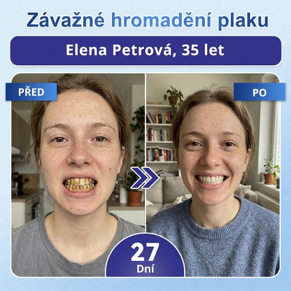 🎁 𝐂𝐨𝐚𝐮𝐨𝐨®Zbývá už jen 5 balení! Nabízíme vám dodatečnou slevu 50 %! 💪 Buďte fit a zdraví. Zhubněte teď — další šance bude až příští rok.