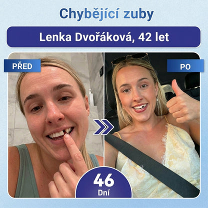🎁 𝐂𝐨𝐚𝐮𝐨𝐨®Zbývá už jen 5 balení! Nabízíme vám dodatečnou slevu 50 %! 💪 Buďte fit a zdraví. Zhubněte teď — další šance bude až příští rok.